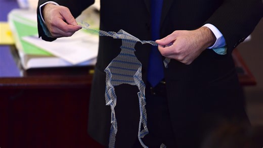 Pelvic mesh jury to decide if device is 'defective' and whether J&J should pay