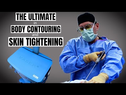 Vaser & Renuvion: Dr. Morales Redefines Liposuction & Skin Tightening!