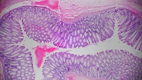 Human Rectum Tissue Magnified Under Microscope in 40 Times Against Bright Field Stock Video - Video of histology, inflammation: 284694453