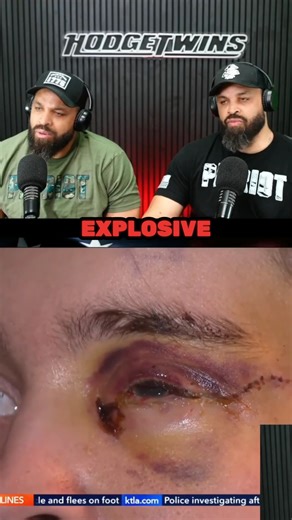Hodgetwins on Instagram: "Trans Person Gets Shot With Non-Leathal Weapon And When Clashing With ICE..."