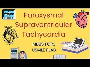 Paroxysmal Supraventricular Tachycardia (PSVT) | ECG, Causes & Management | MBBS FCPS