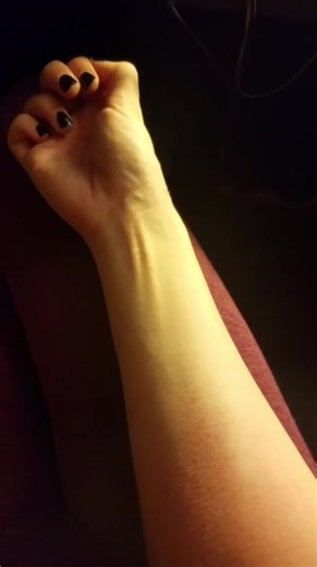 Understanding Hand Cramps: Causes and Solutions