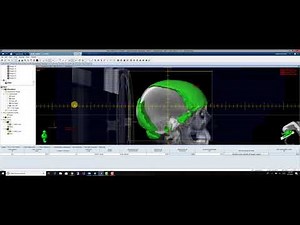 Varian Eclipse Whole Brain Technique