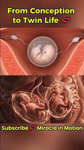 From Conception to Twin Life 💞 | Miracle in Motion#shorts #miracleinmotion #pregnant #baby
