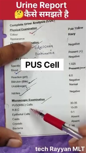 Understanding Urine Microscopic Examination in Pathology