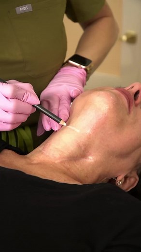 17K views · 269 reactions | #SofwaveInAction // Here's your sign that...