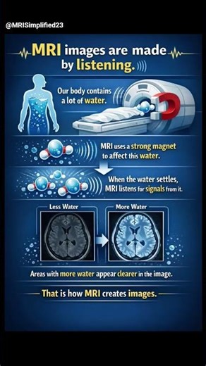 MRI images are made by listening! 🧲👩🏻‍⚕️ #shorts