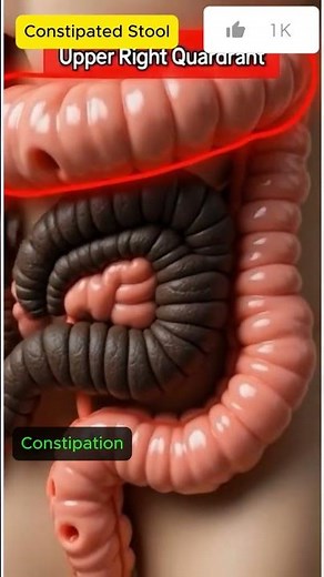 What Constipation Actually Looks Like Inside You 🛑 | Pro07