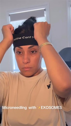 Routine Contour Clinic Melbourne skin cosmetic nurse injector | ✨Watch me perform microneedling with exosomes on myself — intentionally, consciously, and without numbing cream. Why? Because true skin... | Instagram