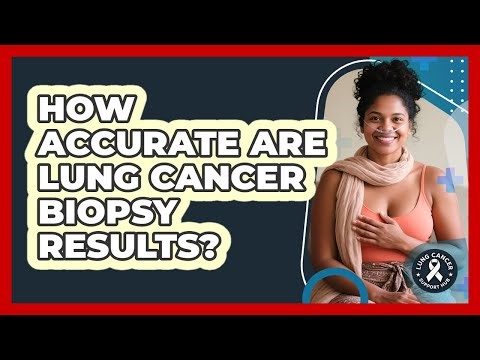How Accurate Are Lung Cancer Biopsy Results? - Lung Cancer Support Hub
