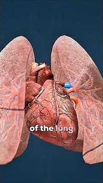 How a Blood Clot Makes it to the Lungs