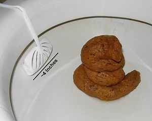 Human feces - Alchetron, The Free Social Encyclopedia
