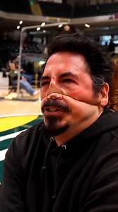 1K views · 10K reactions | Nose pulling competition #facts | Galaxyverse E | Facebook