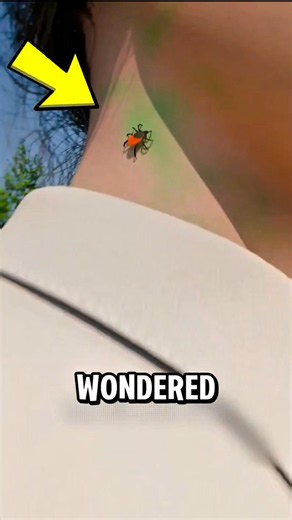 Scientists Just Discovered the REAL Reason Ticks End Up on You! 😱
