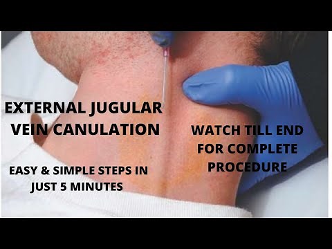 EXTERNAL JUGULAR VEIN CANNULATION PROCEDURE WITH SIMPLIFIED STEPS