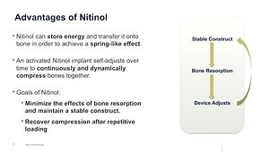 Nitinol Continuous Compressions Implants Technology Overview