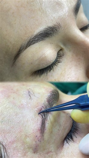 Master the Art of Eyebrow Microblading