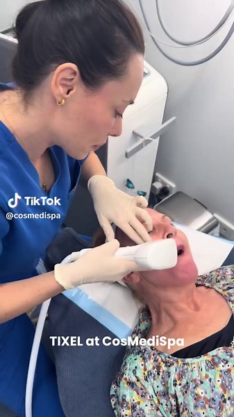 Tixel by Novoxel ✨ Tixel is an advanced skin rejuvenation treatment that uses controlled heat energy to resurface and renew the skin. Unlike traditional lasers, Tixel uses a heated titanium tip that briefly touches the skin and transfers thermal energy directly into the tissue. This creates tiny micro-channels in the skin that stimulate the body’s natural healing response and trigger new collagen and elastin production. As the skin repairs itself, it becomes smoother, firmer and more even in ton