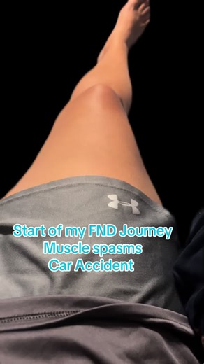 FND Journey started by a car accident. Uncontrollable muscle spasms and tremors of the legs that would last hours. No redirection could get them to stop. My body was so inflamed and in pain. #fnd #fndawareness #musclespasm #tremors #caraccident