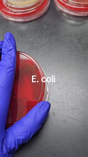 Bacteria identification 🤩 #lablife #medicallaboratoryscience #microbiology | Lab life