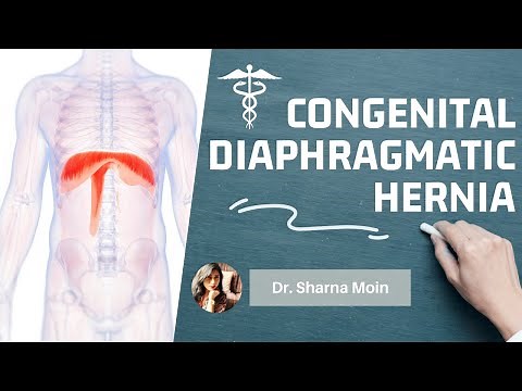 Congenital diaphragmatic hernia CDH types, causes, mechanism, diagnosis & treatment
