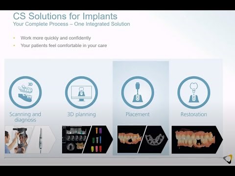 Carestream Dental SMOP Digital Dental Implant Guided Surgery
