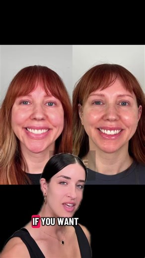 The Nefertiti Botox neck lift 💉 | Cassandra Giampa