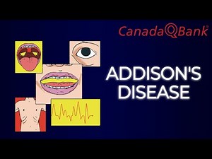 Addison Disease Explained | Primary Adrenal Insufficiency, Diagnosis & Treatment | CanadaQBank