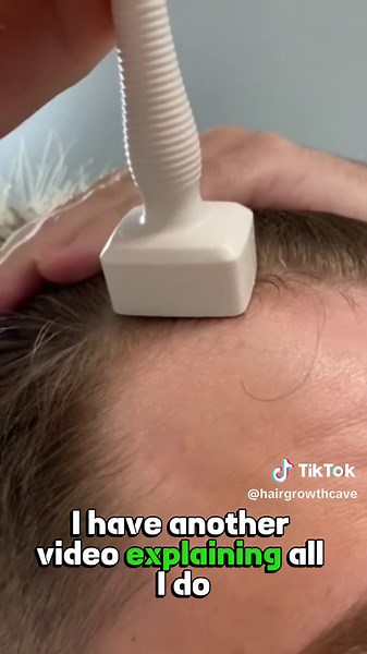 Tips for Increasing Beard Growth Naturally