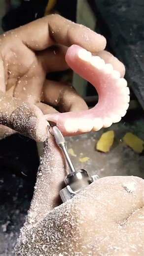 Lower Acrylic Removable Partial Denture Finishing By Haider 😁😁😁#rpddentalprocedure#viralvideo