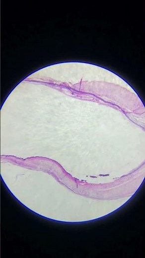 hyaline cartilage under microscope #microbiology #infectiousdiseases #cellbiology #marinebiology