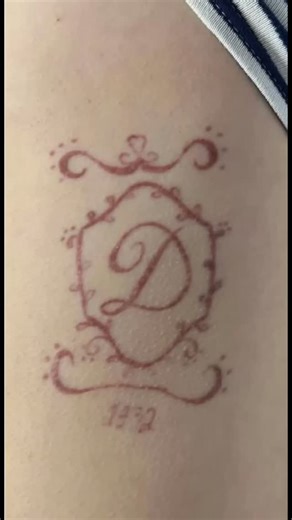 🔬 Why Red Inks can be tricky to Remove? Red tattoo pigment is often made from compounds like mercury sulfide (cinnabar) or azo dyes, which have different light absorption properties compared to black ink. Because of that: ♦️Red pigments absorb green light best, so they respond primarily to lasers in the 532 nm wavelength range. Ready to start your journey to tattoo-free skin? Book your appointment now: 📞01543 379895 📧 revivelaser@outlook.com | Revive Laser