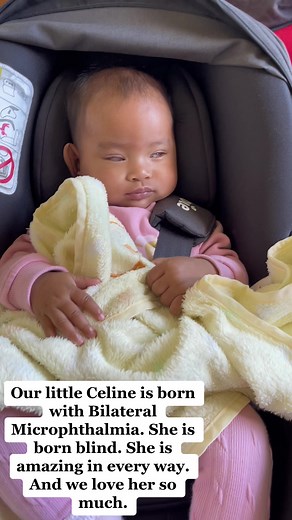 Our sweet little Celine is born blind and its called Bilateral Microphthalmia. Its a rare condition. There's no treatment that can create a new eye or bring vision back for people born with microphthalmia. These conditions affect about 1 in 10,000 infants born each year. So if you know someone with this condition, respect their disability and love them in every way. #fypシ゚viral #fyp #fyppp #blindawareness #bornblind #microphthalmiaawareness #blindbaby
