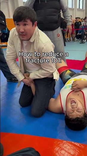 How to reduce a fracture like a SAVAGE #doctor #orthopedics