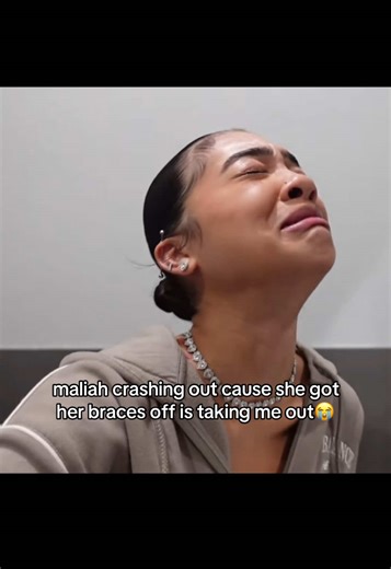she looks tea without her braces || #fypシ゚viral #bandbabyliah #jayshawn #luhskully #cheating #breakup #funny #braces #repost #relateable #fyppppppppppppppppppppppp