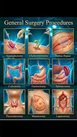 General Surgery Procedure Names✅ #trending #otassistant #shorts #medicalhindi #youtube #viral #nurse