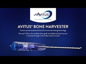 Avitus® Bone Harvester – 6mm Edition Product Launch - Calcaneus Demo