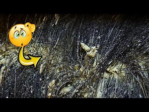 WOW!!! Itchy Dry Scalp Scratching Dandruff Removal | Dandruff Scratching