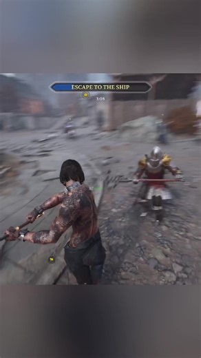 Chivalry 2: A Fun Adventure with Trousers and Dreams