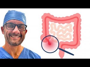 How I Diagnose Appendicitis as a Surgeon