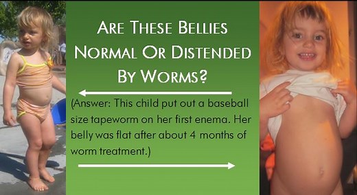 Parasites - Debug Your Health