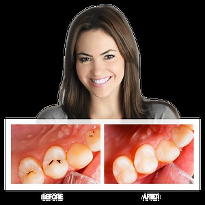 Biologic and Mercury Free Dentistry Nashua NH - Holistic Dental
