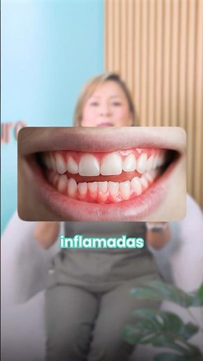 ¿Qué es la ENFERMEDAD PERIODONTAL? (Y cómo se cura) 🩸🦷
