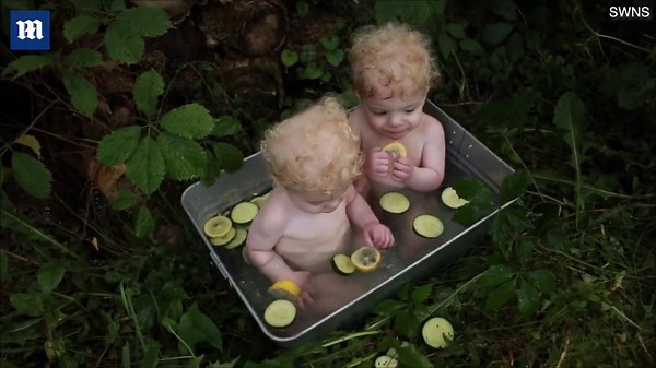 Parents of albino twins move 3000 miles to protect them from the sun