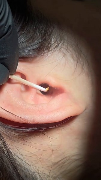 파모라 1팀 워크샵: 귀의 알갱이 제거 비결