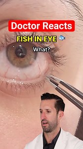 Doctor Reacts to “Most Satisfying” Eyeball Mucus Removal 😖 | Doctor ER