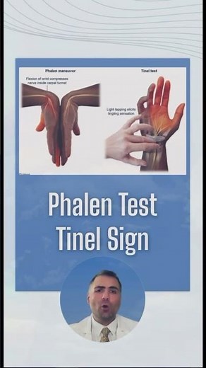 Phalen Test and Tinel's Sign