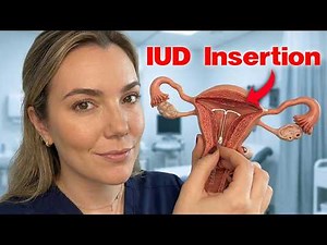 What happens when you get a coil fitted?