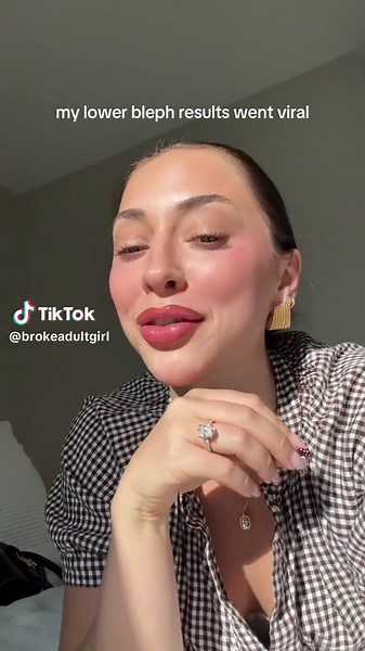 Lower Blepharoplasty Journey: Eye Bag Removal Explained