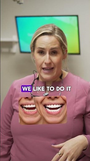 Veneer Prep Explained… And Why It Matters 😍🦷